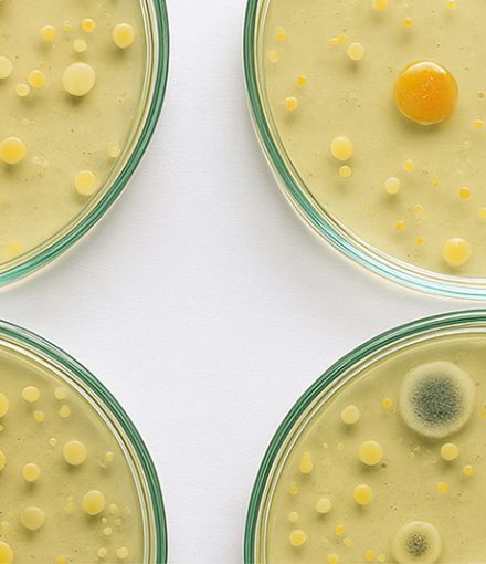 Antibioticoterapia_800x533 Antibioticoterapia_800x533